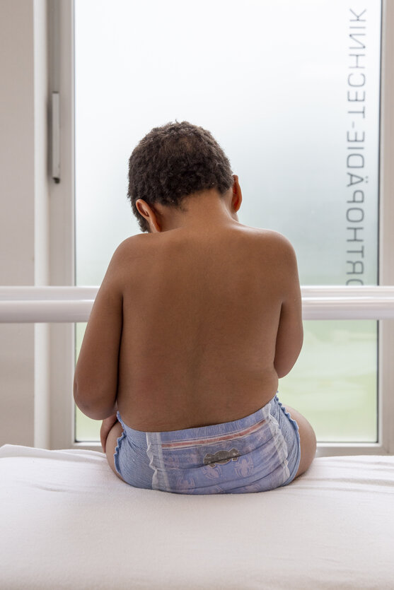 Junge mit neurogener Wirbelsäulendeformität | © Pohlig GmbH