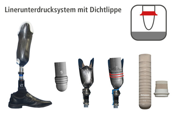 Unterschenkel-Prothese | Orthopädie-Technik | Pohlig GmbH